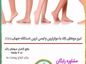 لیزر موهای زائد