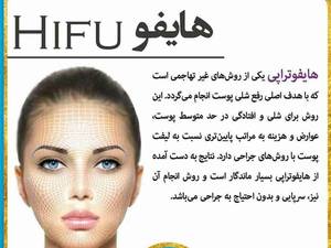 هایفو تراپی قوی ترین وسیله غیر تهاجمی برای لیفت در جهان