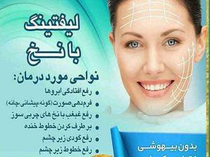 لیفت با نخ