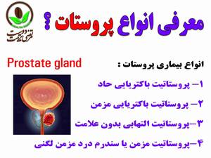معرفی انواع بیماری پروستات