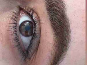 کلینیک تخصصی میکروبلیدینگ در یاسوج