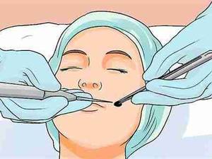 برداشت خال