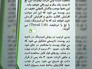 جوانسازی با نخ در رشت گلسار