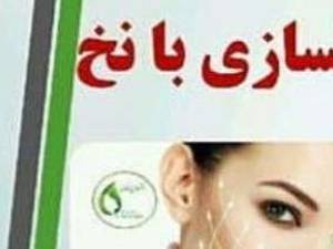 جوانسازی با نخ در رشت گلسار