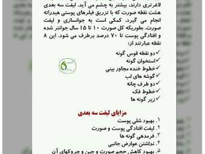 لیفت سه بعدی هشت نقطه صورت در رشت