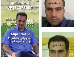 کلینیک کاشت مو گیلان فیت دکتر مهدوی. رشت