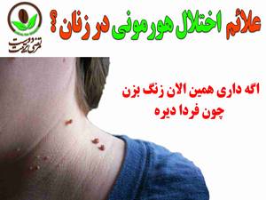 علائم  اختلال هورمونی در زنان چیه ؟