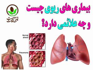 بیماری‎ های ریوی چیست  و چه علائمی دارد؟
