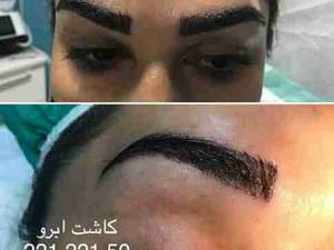 کاشت ابرو طبیعی و چگونگی آن