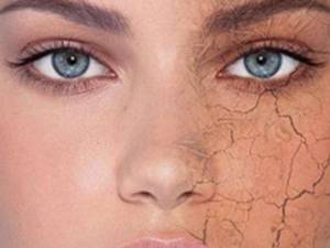 آبرسانی پوست در کلینیک آریادرم