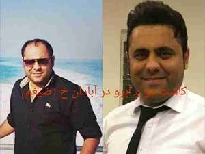 کاشت مو توسط کلینیک سینا در خرمشهر