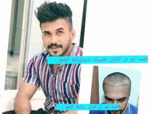 اولین کلینیک تخصصی پوست و کاشت مو در آبادان