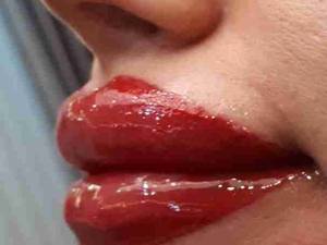 رژ لب با دستگاه پزشکی آمیا در رشت