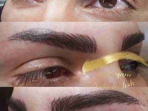 میکروپیگمنتیشن با دستگاه پزشکی آمیا در رشت