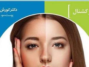 آر اف فرکشنال