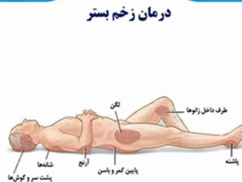 درمان تخصصی زخم بستر