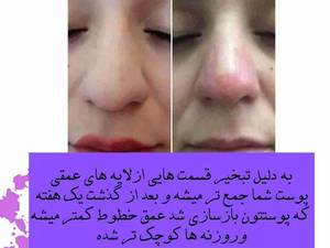 با پلاسما عیب ها رو برطرف کن!