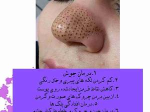 با پلاسما عیب ها رو برطرف کن!