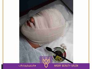 کربوکسی تراپی بدون روش تهاجمی