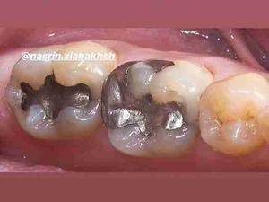 دندانپزشکی دکتر نسرین ضیا بخش در چالوس