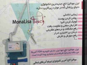 لیزر مونالیزا تاچ