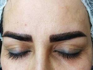 فیبروز ابرو بصورت کاملا تخصصی در اصفهان