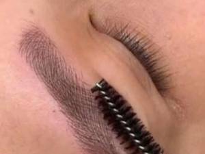 میکروبلیدینگ به روش فیبروز