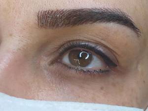 فیبروز و بن مژه اصفهان