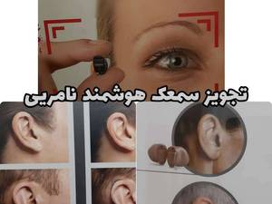 ارزانترین سمعک نامرئی در سمنان