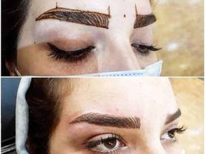 آموزش اجرای تلفیقی میکروبلیدینگ و شیدینگ در رشت