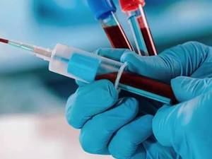 پذیرش و نمونه گیری آزمایشات در منزل