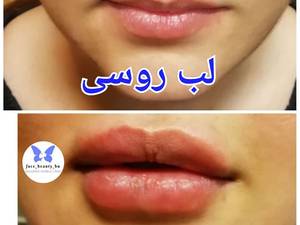 لب روسی