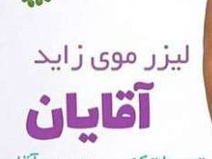 لیزر موهای زائد