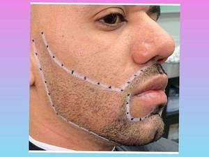 مرکز میکرو اسکالپ در ساری