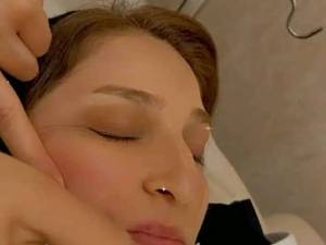 میکرو ابریژن