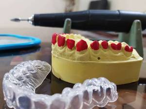 تری بلیچینگ حرفه ایی در اصفهان