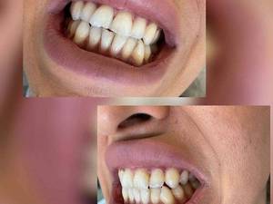 کامپوزیت حرفه ایی سعادت آباد