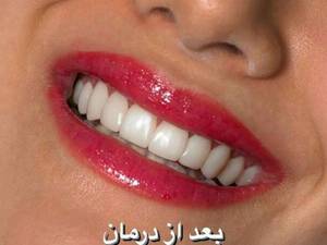 حرفه ایی ترین کامپوزیت ماهشهر
