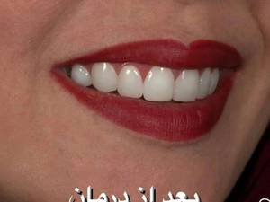 بهترین دندانپزشکی خوزستان