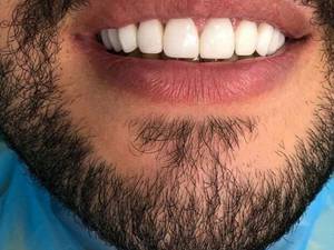 ارزانترین کامپوزیت ونیر در ماهشهر