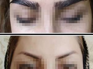 کاشت ابرو فوق العاده طبیعی و حرفه ای در شیراز