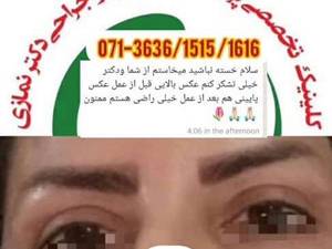 عمل پلک در شیراز