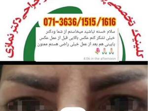 عمل پلک در شیراز