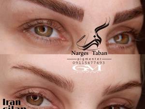 میکروبلیدینگ نرگس در رشت