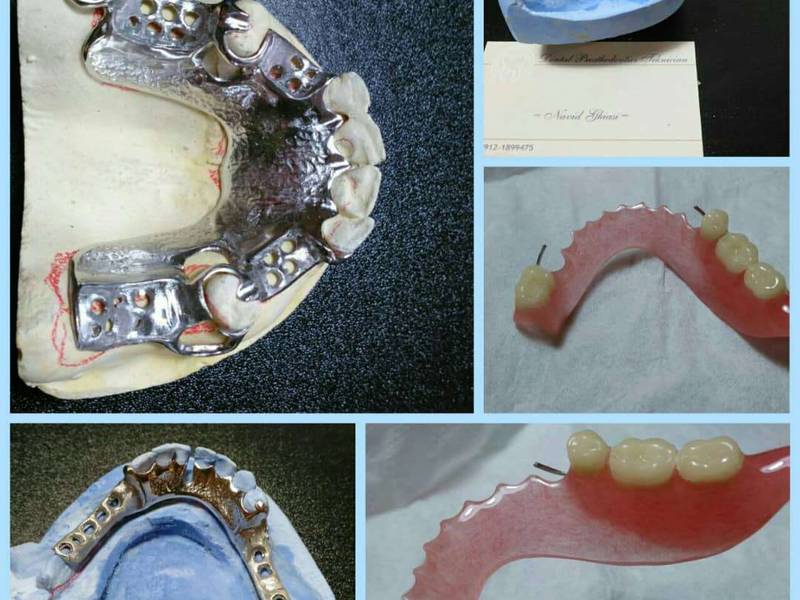 حرفه ایی ترین پروتز اکریلی و کروم کبالت