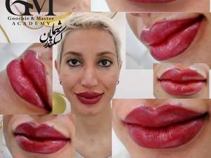 میکروبلیدینگ شیما اسکندریان اراک