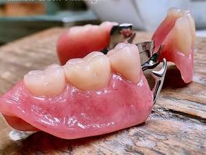 ساخت حرفه ایی ترین  کروم کبالت اصفهان