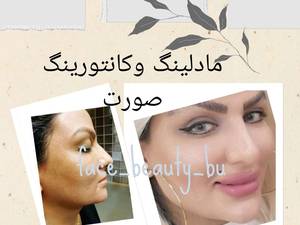 مادلینگ صورت