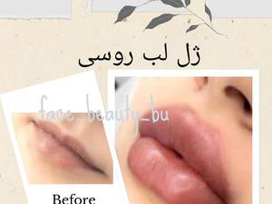 ژل لب روسی در بوشهر
