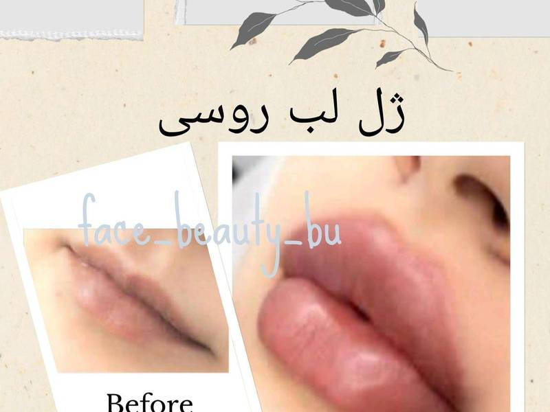 ژل لب روسی در بوشهر